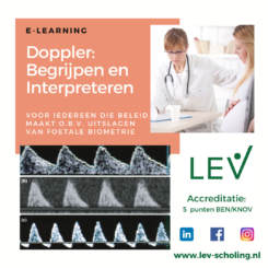 Doppler begrijpen en interpreteren